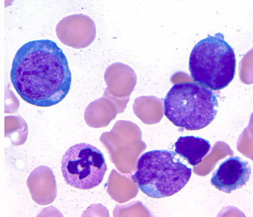 Image 7 aspirate 100x 2